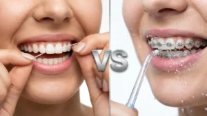 Water Flosser vs String Floss for Gum Disease